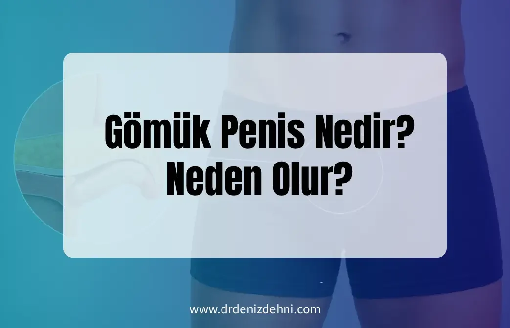 Gömük Penis Nedir? Gömük Penis Nedir?