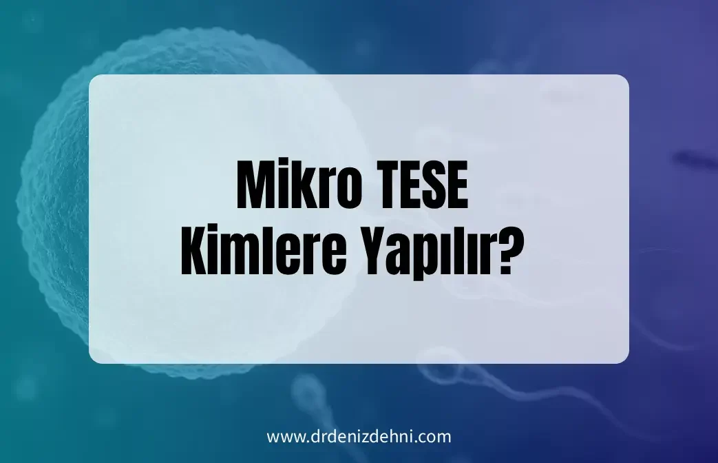 Mikro TESE Kimlere Yapılır? Mikro TESE Kimlere Yapılır?
