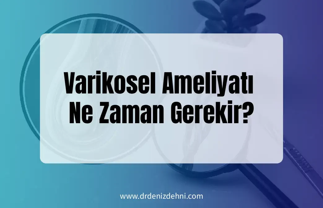 Varikosel Ameliyatı Ne Zaman Gerekir?